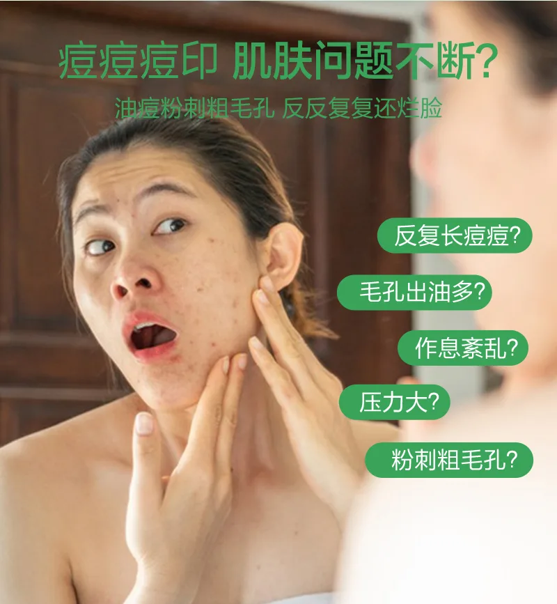 Xinoss 20ml Oil Control Acne Serum 3