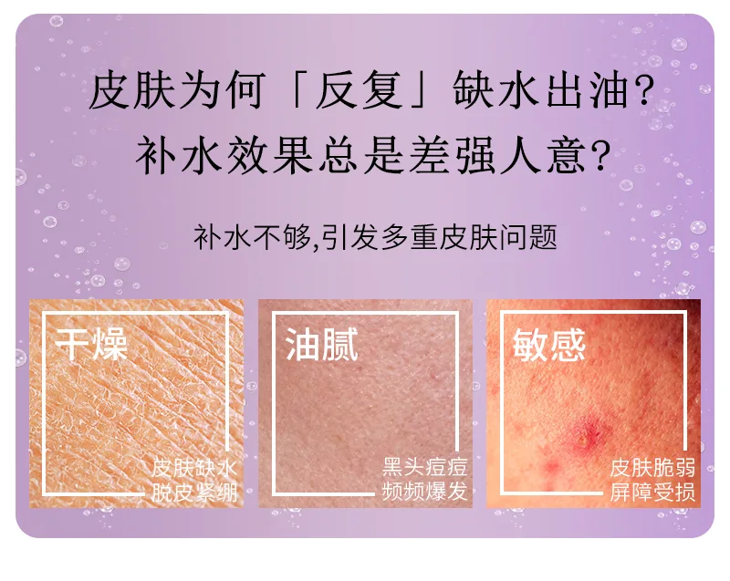 Xinoss Hydrating Beauty Essence Lotion 3
