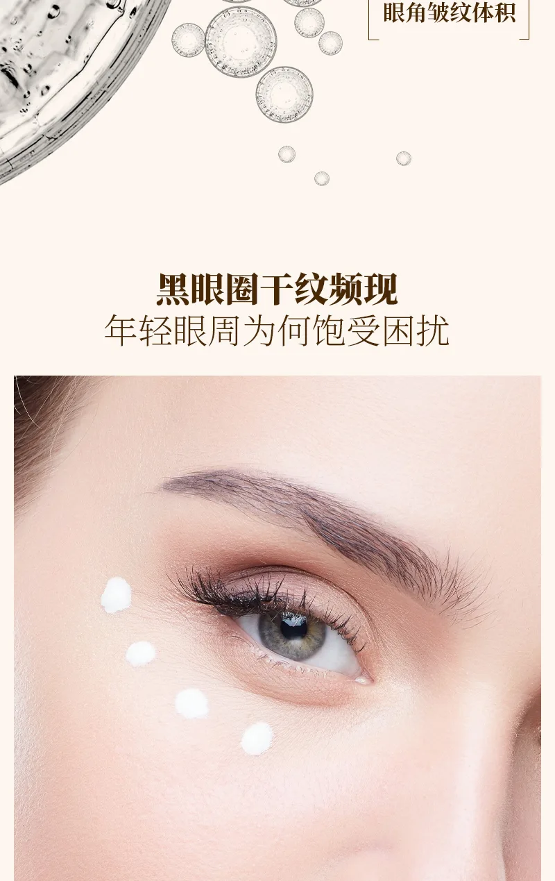 시노스 20g 프로자일란트림 항주름 아이크림 4
