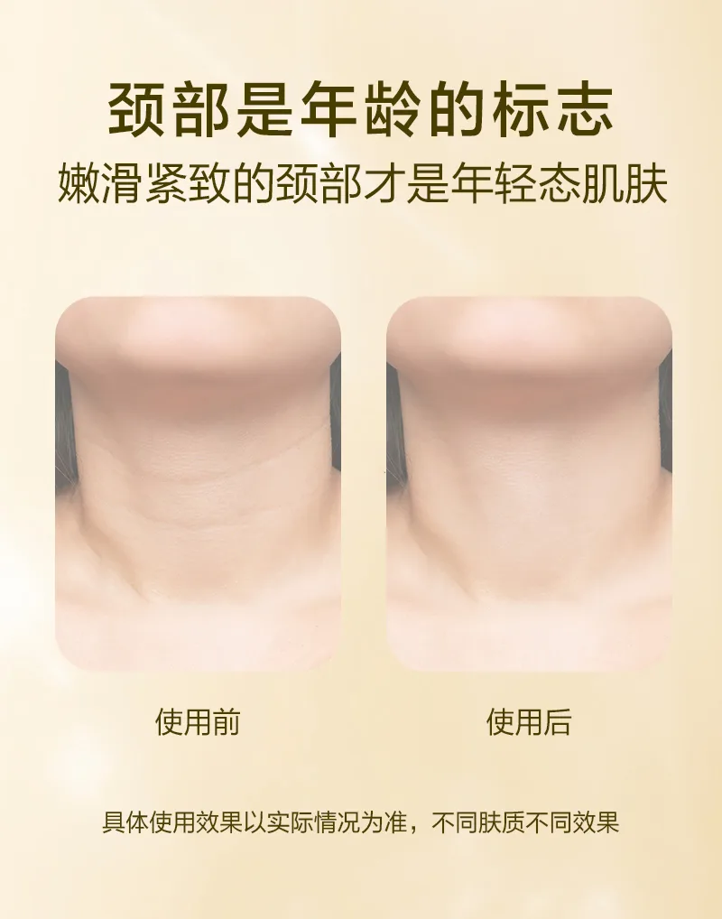Xinoss Neck Wrinkle Smoothing Stick / 14g 8