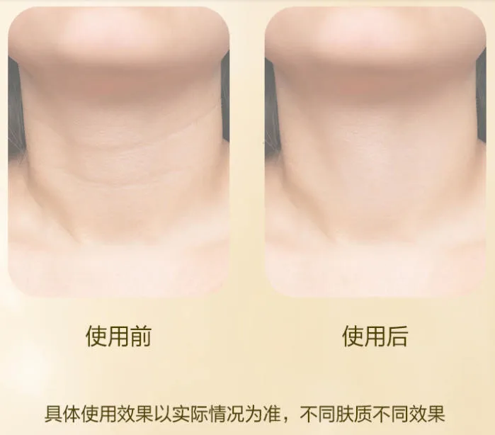 Xinoss Neck Wrinkle Smoothing Stick / 14g