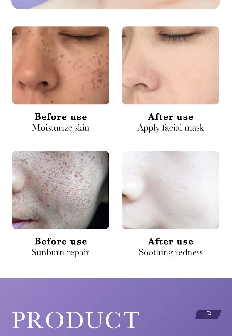 SADOER Nicotinamide facial mask Multi piece Display Whitening, Moisturizing and Spot Removing Cross border E-commerce Skin Ca