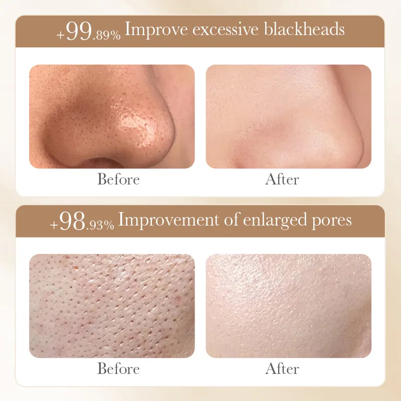 BIOAOUA rice puree tear-off mask close-up showing creamy texture for blackhead and acne removal, wholesale skincare