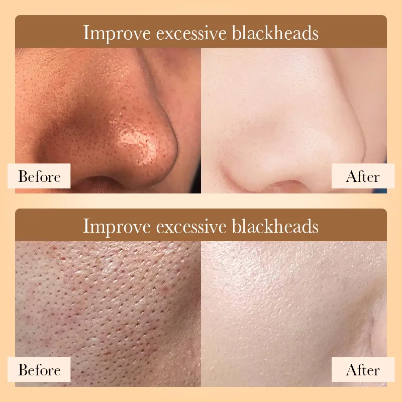 BIOAOU rice puree mud mask stick close-up showing creamy texture and twist-up design for deep cleansing