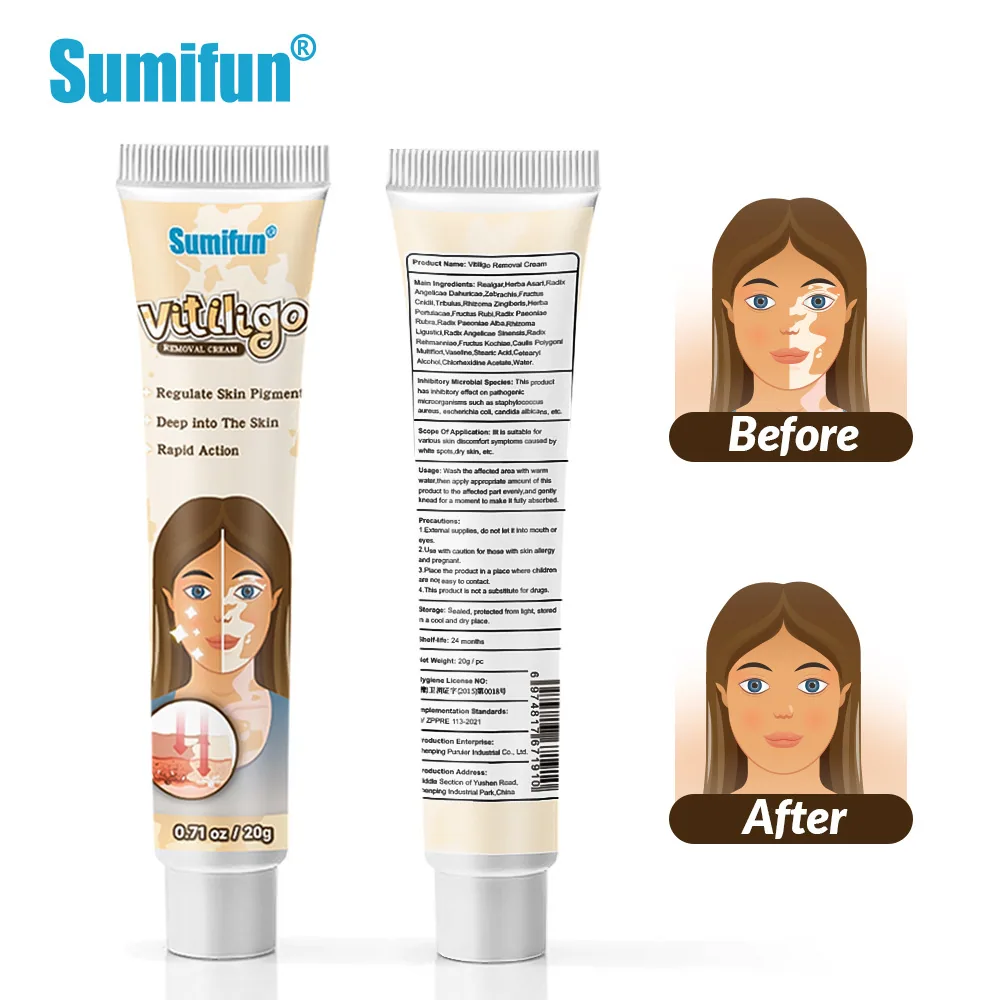 Sumifu AliExpress Temu Cross border White Spot Cleansing Cream Vitiligo Repair Skin Care Cream K10073 11