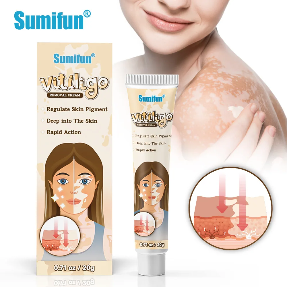 Sumifu AliExpress Temu Cross border White Spot Cleansing Cream Vitiligo Repair Skin Care Cream K10073 6