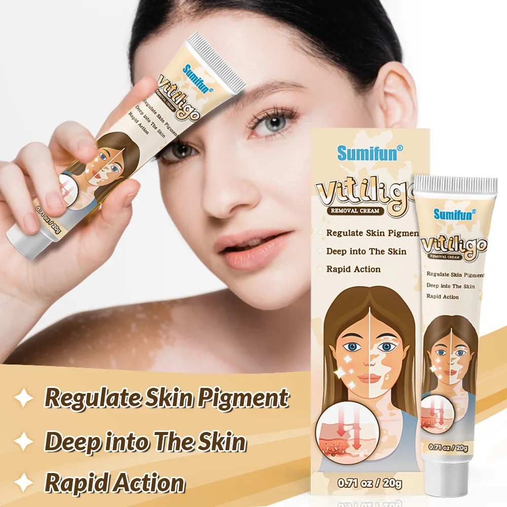 Sumifu AliExpress Temu Cross border White Spot Cleansing Cream Vitiligo Repair Skin Care Cream K10073 2