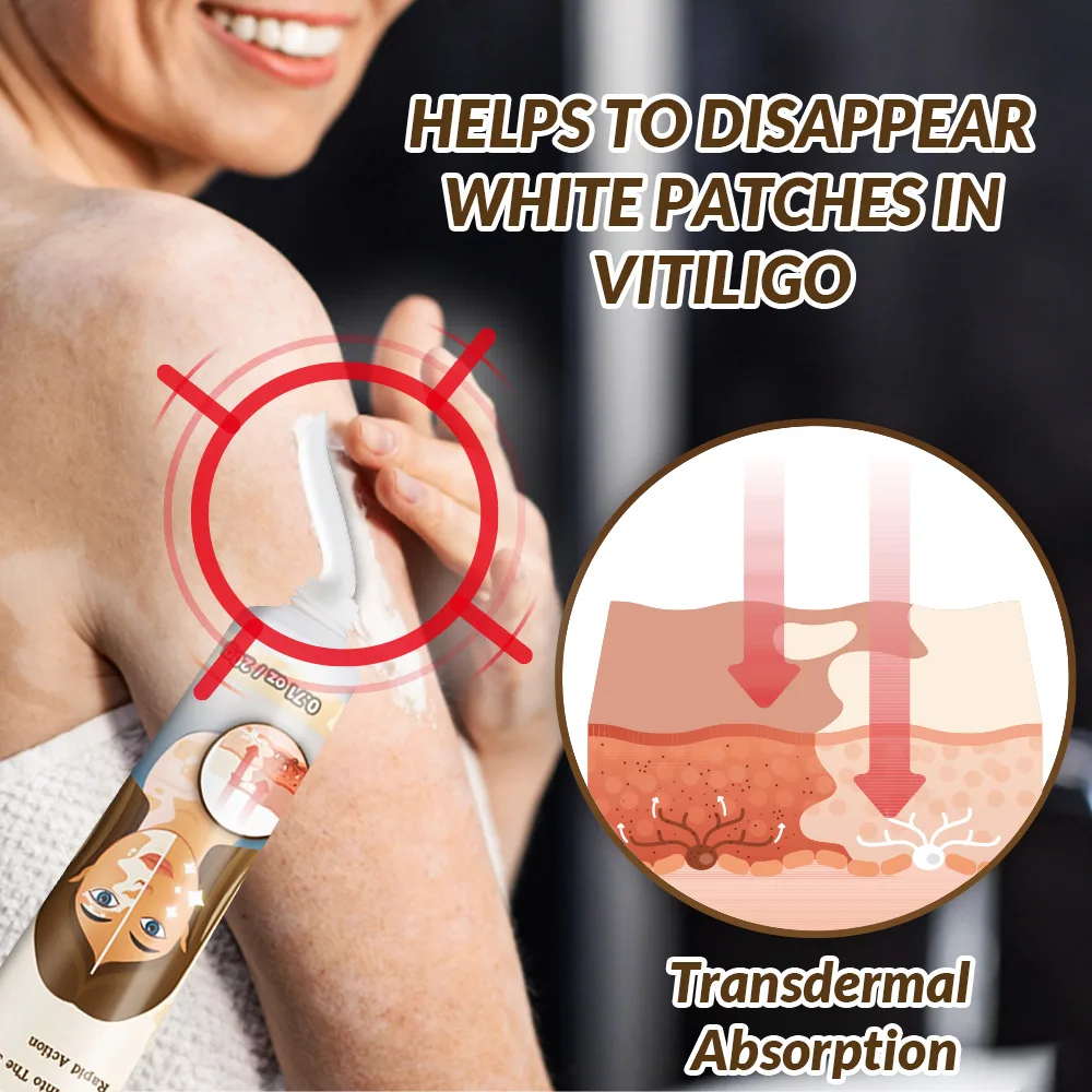 Sumifu AliExpress Temu Cross border White Spot Cleansing Cream Vitiligo Repair Skin Care Cream K10073 5