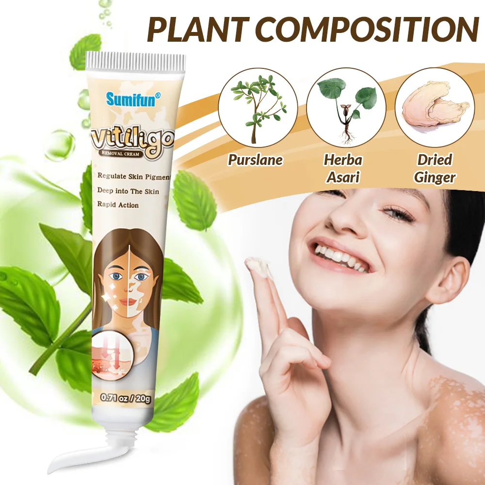 Sumifu AliExpress Temu Cross border White Spot Cleansing Cream Vitiligo Repair Skin Care Cream K10073 13