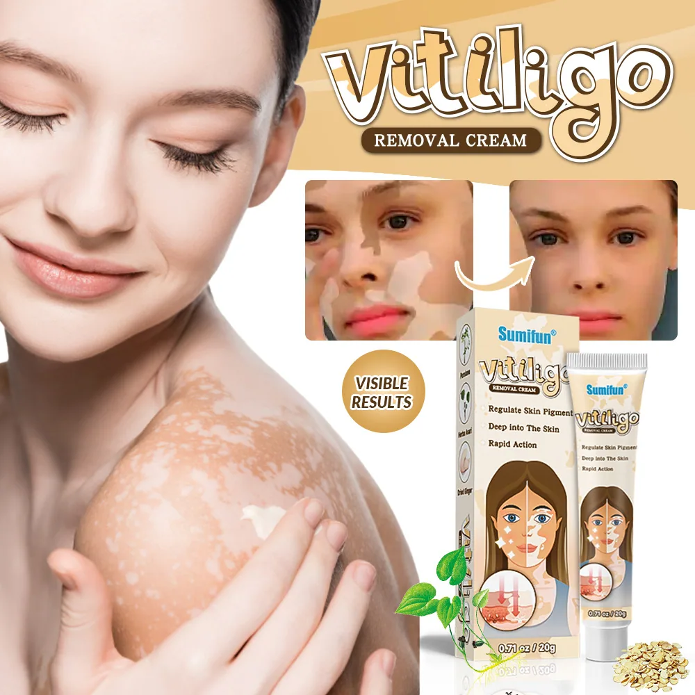 Sumifu AliExpress Temu Cross border White Spot Cleansing Cream Vitiligo Repair Skin Care Cream K10073 4