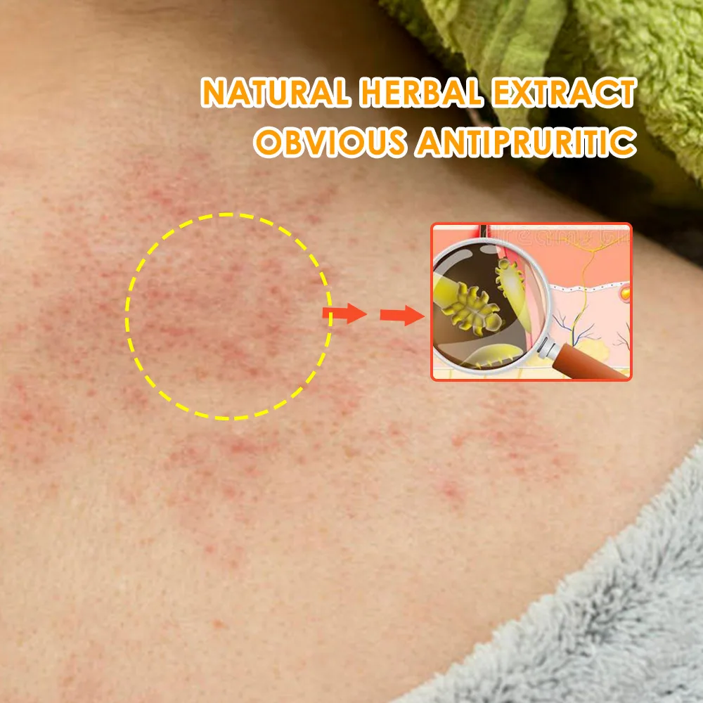 Sumifu Amazon Temu AliExpress Hair Follicle Cream Skin Care Folliculitis Pores Coarse K10108 14