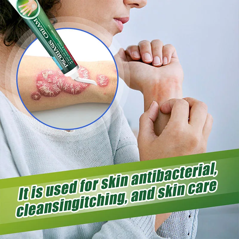 Sumifu Skin Tinian Cream Shopee Amazon Lazada Psoriasis Skin Topical K10086 3