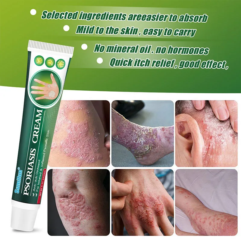 Sumifu Skin Tinian Cream Shopee Amazon Lazada Psoriasis Skin Topical K10086 8