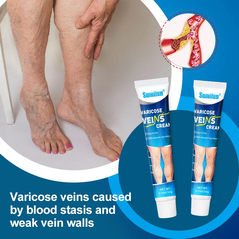 Sumifu Cross border Foreign Trade Vein Ointment Blue Mailishu Ointment Earthworm Leg Vascular Ointment 20GK10025 4