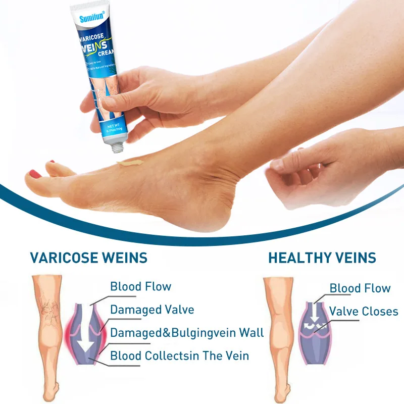 Sumifu Cross border Foreign Trade Vein Ointment Blue Mailishu Ointment Earthworm Leg Vascular Ointment 20GK10025 2