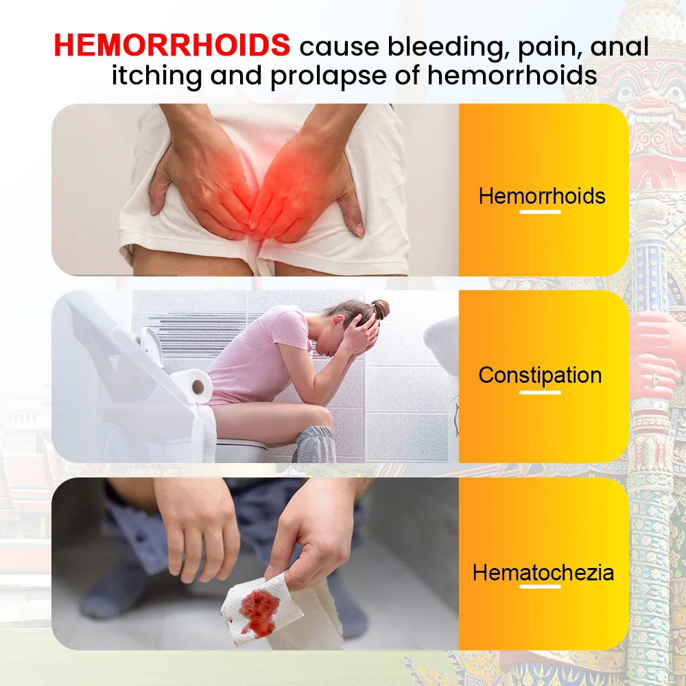 Sumifu Thai Hemorrhoids Cream Amazon AliExpress Cross border Thai Spot Meat Hemorrhoids B Blood Care Cream K10167 8