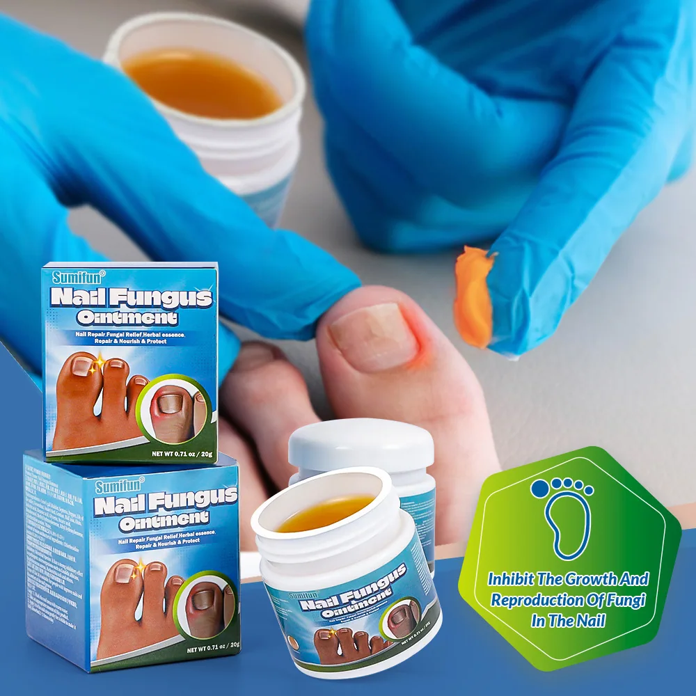 Sumifu Rentas sempadan Jiagou Kang Cream Krim Penjagaan Kaki Kelabu Pereputan Kuku Seni Kuku K20029 4