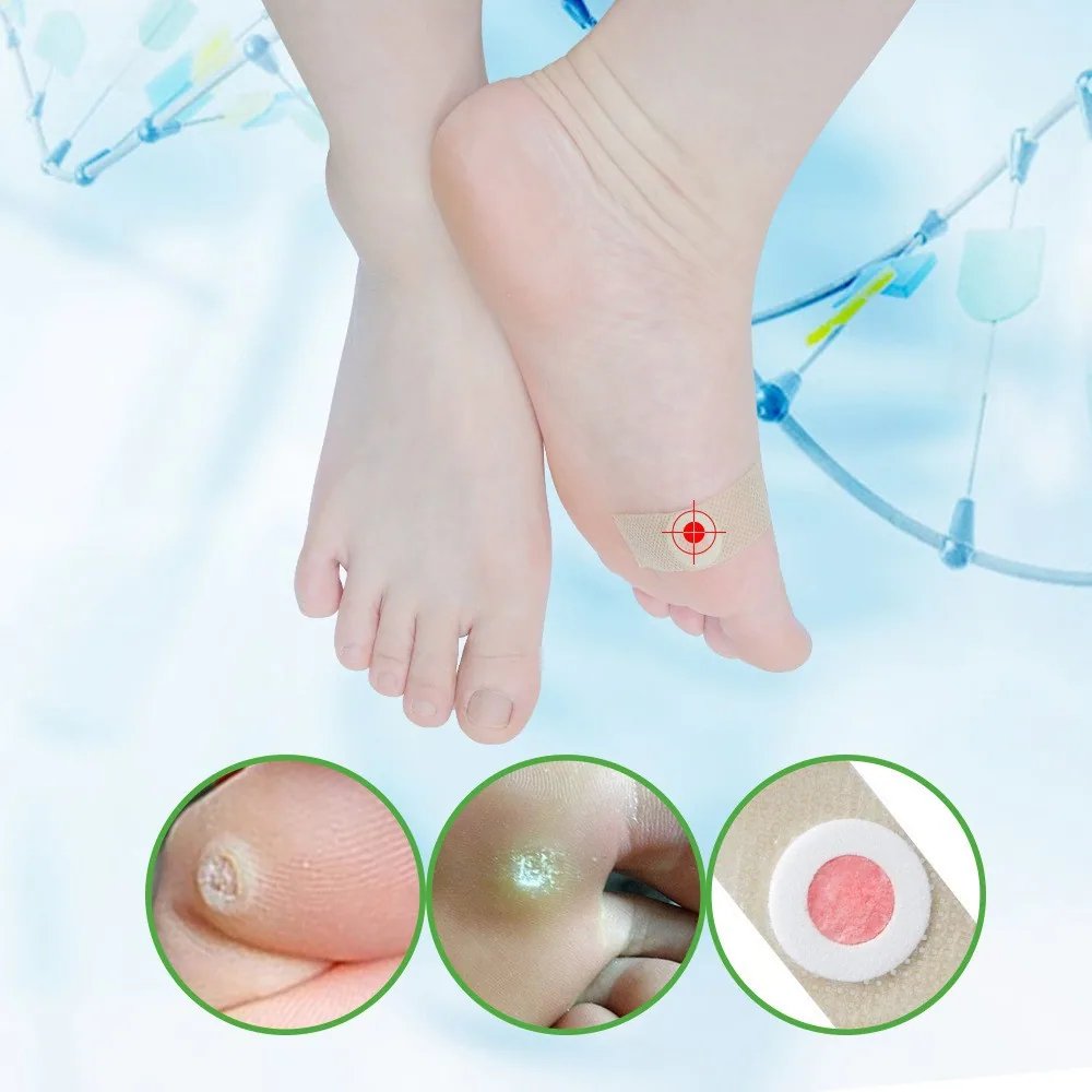 Foreign Trade Cross border AliExpress Wish Joom English Chinese Bilingual Version Chicken Eye Patch Patch 42 Tablets/Box K04401 - Set Top Box 10