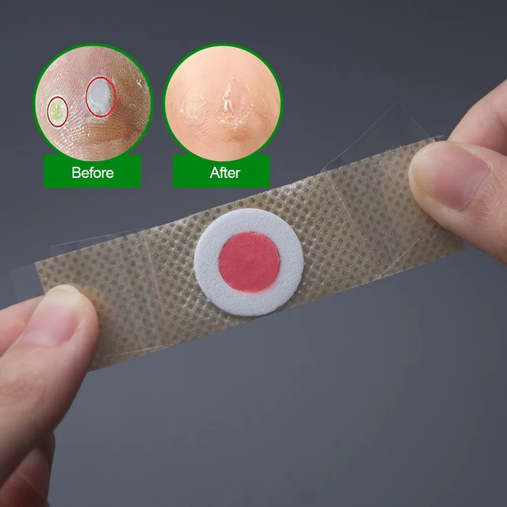 Foreign Trade Cross border AliExpress Wish Joom English Chinese Bilingual Version Chicken Eye Patch Patch 42 Tablets/Box K04401 - Set Top Box 3