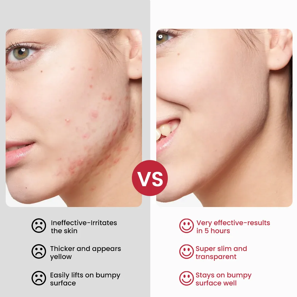 Sumifu Cross border Acne Cream AliExpress Lazada Amazon Shopee Hearthstone Skin Care K10181 14