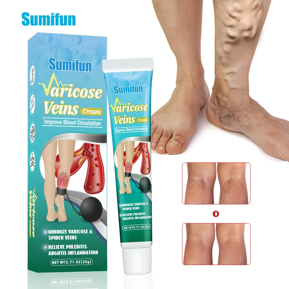 Sumifu AliExpress Wish New Product Maikang Cream Skin Venous Ointment YI Mushroom Cream 20g K10068