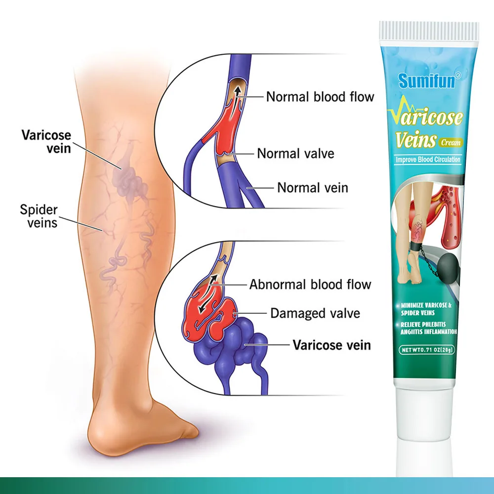 Sumifu AliExpress نئی مصنوعات Maikang Cream Skin Venous Ointment YI مشروم کریم 20g K10068 کی خواہش 8