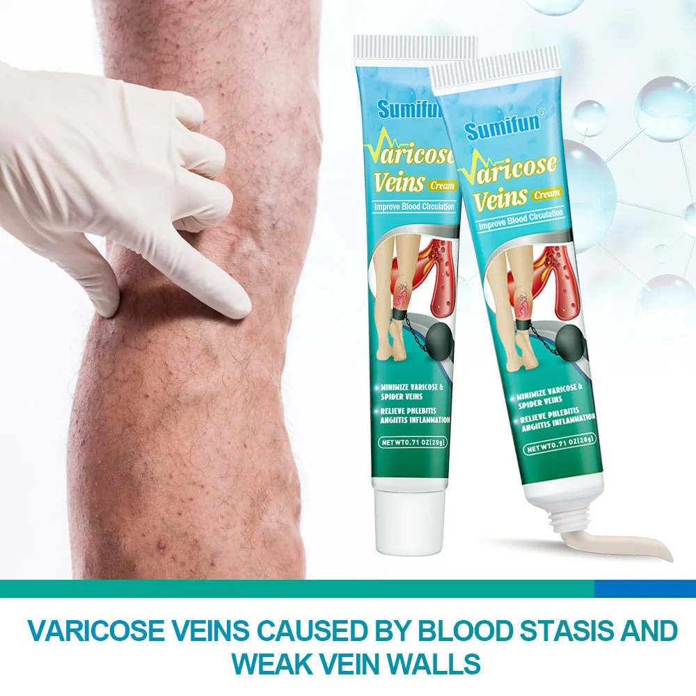 Sumifu AliExpress نئی مصنوعات Maikang Cream Skin Venous Ointment YI مشروم کریم 20g K10068 کی خواہش 5