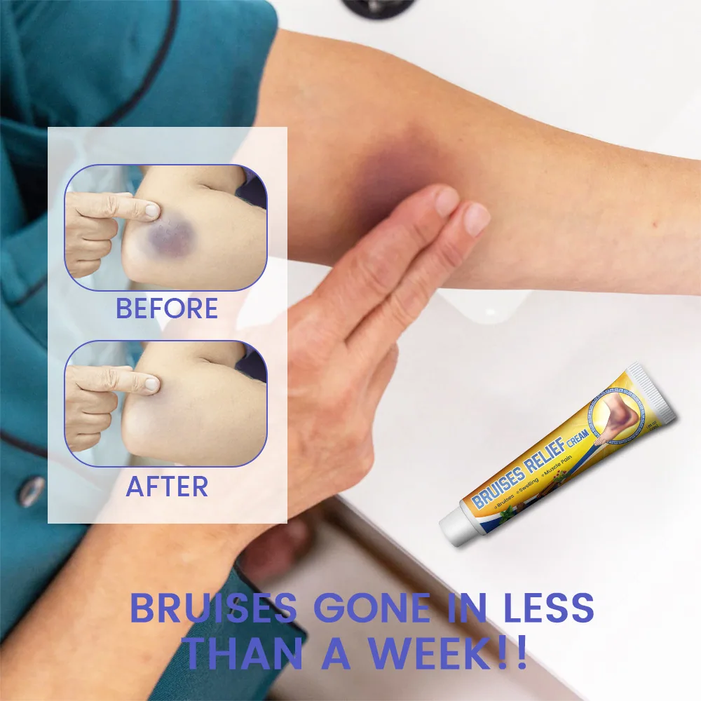 Sumifu Amazon TEMU Cross border Foreign Trade bruise cream for sports and fitness, collision and injury cream K10133 - Other Fitness & Bodybuilding Products 9