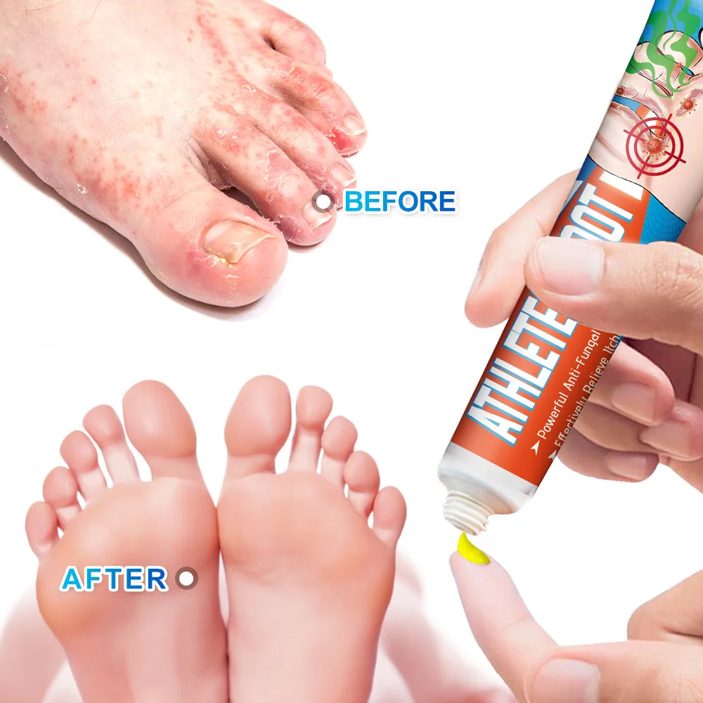 Sumifu Foot Cream Amazon Temu Cross border Foreign Trade Foot Stinky Sweat Foot Itching Foot Care Cream K10136 7