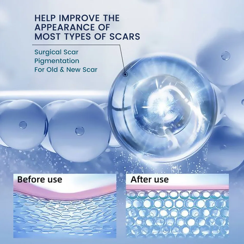 Sumifun Lavender Scar Cream เจลลบรอยแผลเป็น Amazon Tiktok สถานีอิสระข้ามพรมแดน การค้าต่างประเทศ K10202 4