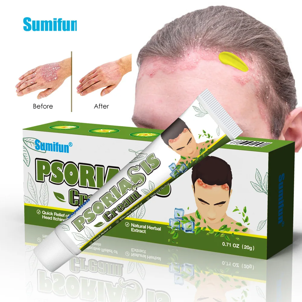 Sumifu Amazon TEMU Cross border Psoriasis Soothing Cream for Forehead Hair Body Care Cream k10134 5
