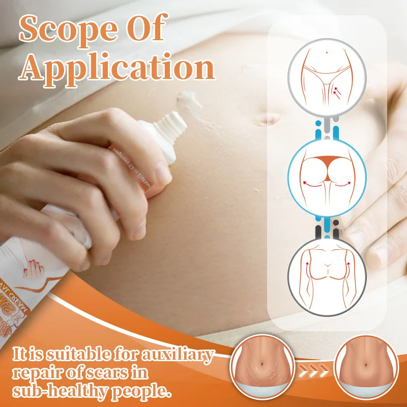 Sumifu Amazon Cross border Stretch Scar Removal Cream Scar Repair Ointment 20g K10078 on AliExpress 4