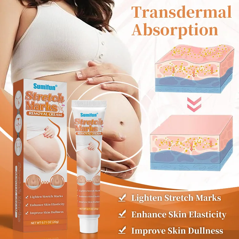 Sumifu Amazon Cross border Stretch Scar Removal Cream Scar Repair Ointment 20g K10078 on AliExpress 5