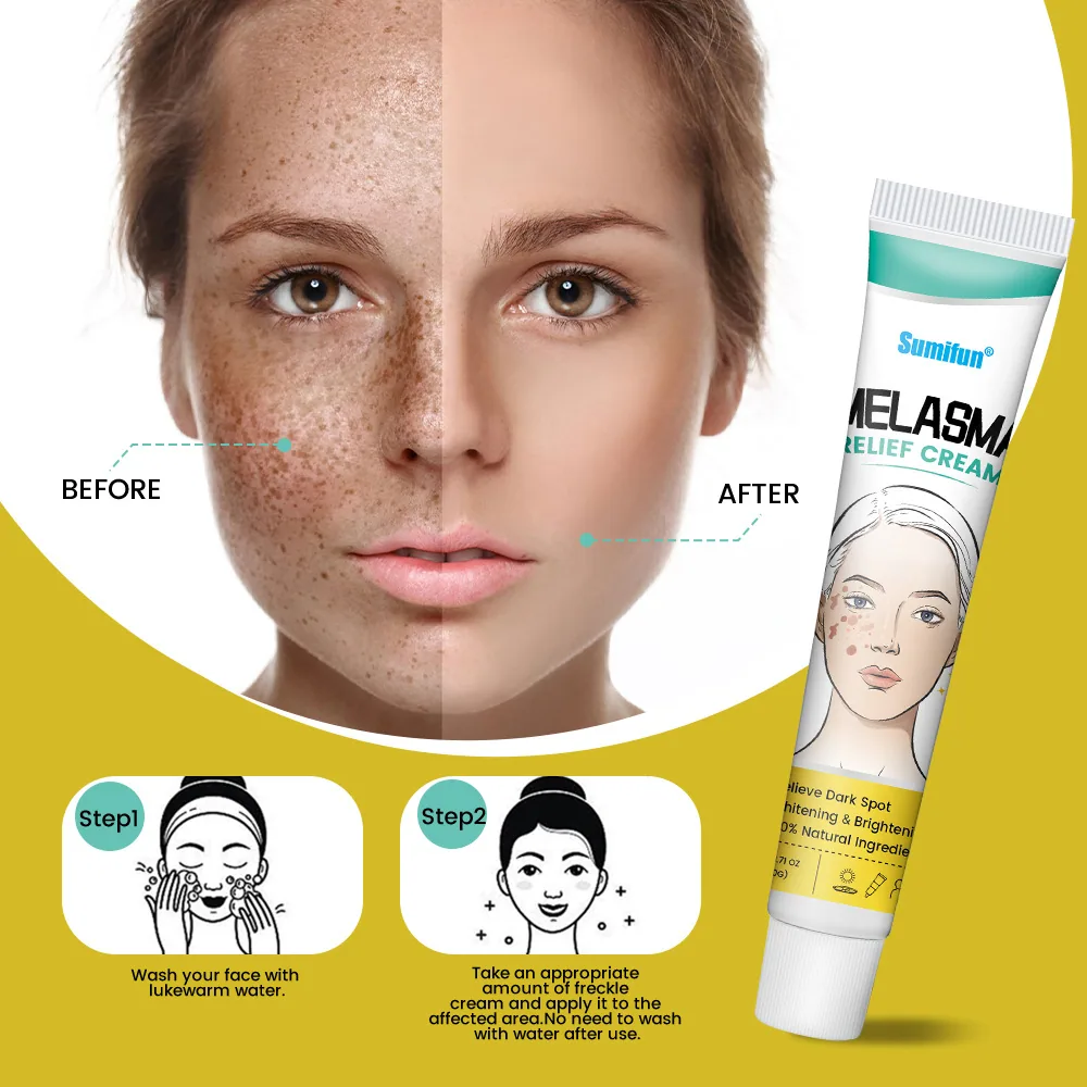 Sumifu Amazon AliExpress Cross Border Melasma-Behandlungscreme Facial Beauty Freckle Fading Cream K10143 5