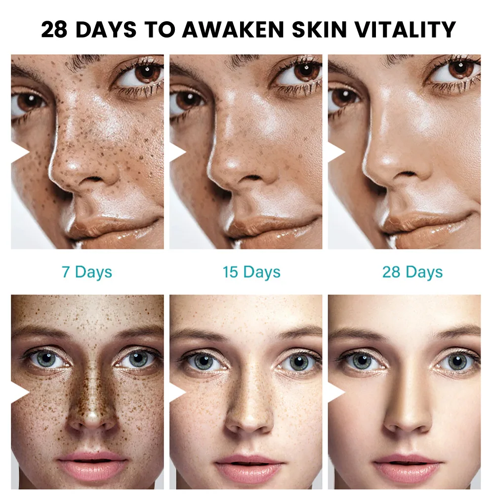 Sumifu Amazon AliExpress Cross Border Melasma-Behandlungscreme Facial Beauty Freckle Fading Cream K10143 2