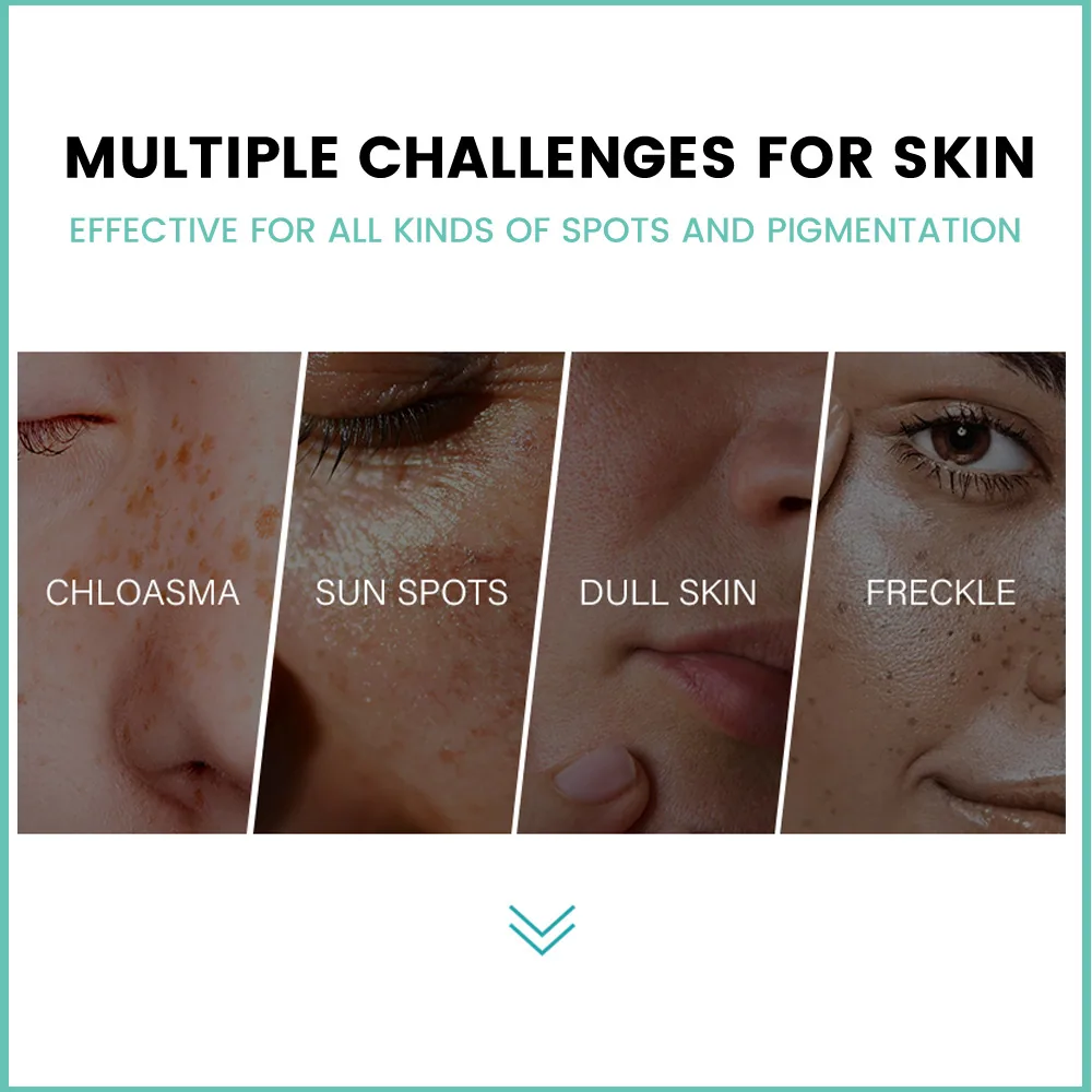 Sumifu Amazon AliExpress Cross Border Melasma-Behandlungscreme Facial Beauty Freckle Fading Cream K10143 8
