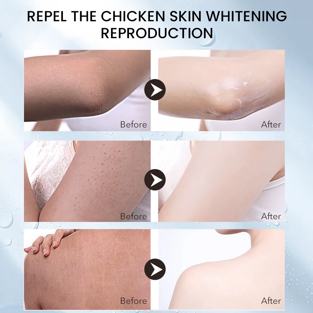 Sumifu crème pour la peau de poulet à la vitamine E Amazon TEMU commerce extérieur transfrontalier exfoliation à l'urée varech K20069 16