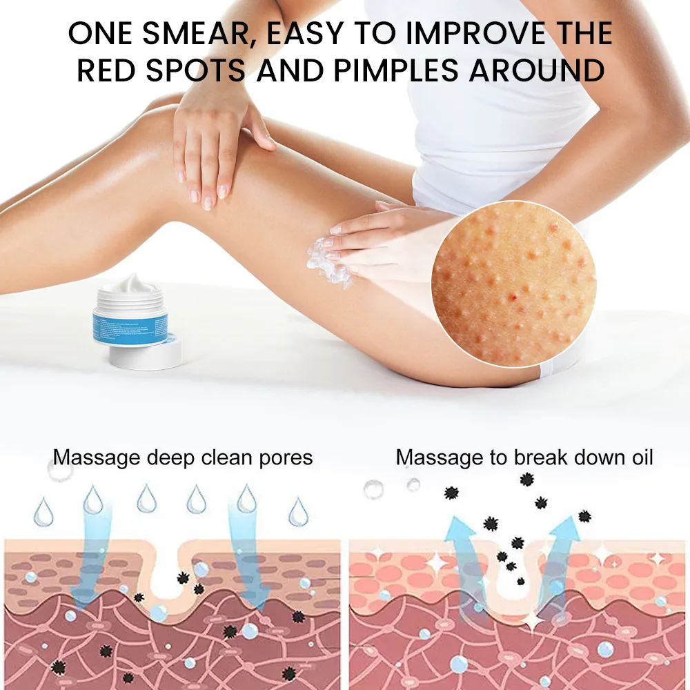 Sumifu crème pour la peau de poulet à la vitamine E Amazon TEMU commerce extérieur transfrontalier exfoliation à l'urée varech K20069 6