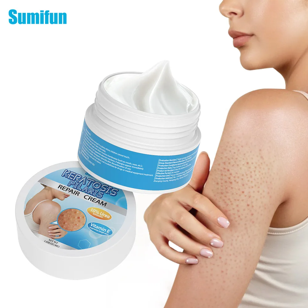 Sumifu crème pour la peau de poulet à la vitamine E Amazon TEMU commerce extérieur transfrontalier exfoliation à l'urée varech K20069 13