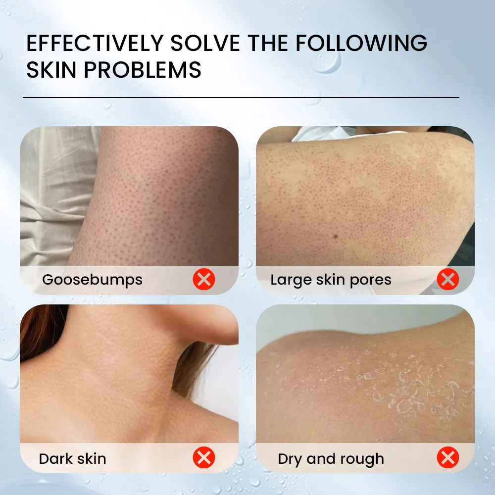 Sumifu crème pour la peau de poulet à la vitamine E Amazon TEMU commerce extérieur transfrontalier exfoliation à l'urée varech K20069 5