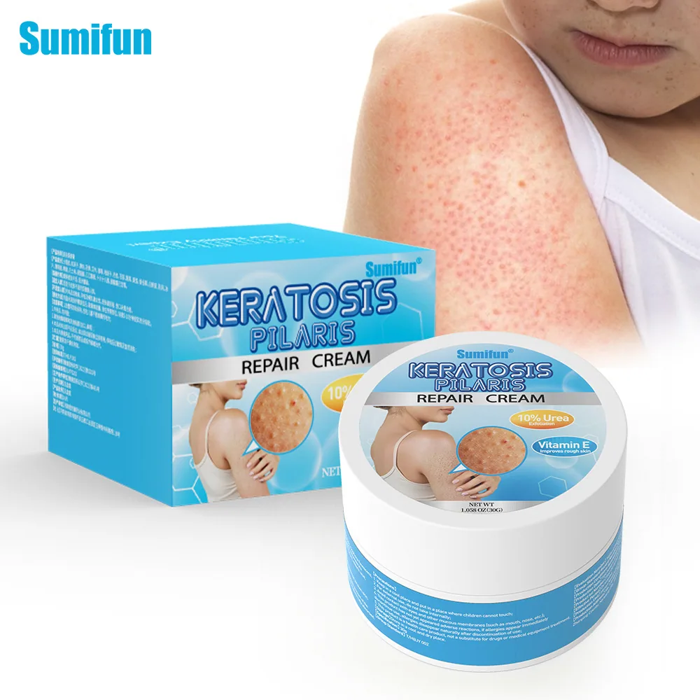 Sumifu crème pour la peau de poulet à la vitamine E Amazon TEMU commerce extérieur transfrontalier exfoliation à l'urée varech K20069 3
