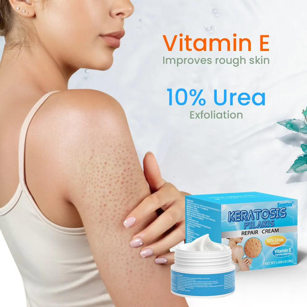 Sumifu crème pour la peau de poulet à la vitamine E Amazon TEMU commerce extérieur transfrontalier exfoliation à l'urée varech K20069 14