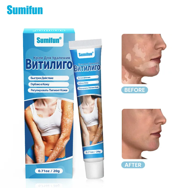 Sumifu White Spot Cream Amazon Tiktok Cross border Foreign Trade Russian Flower Spot Sweat Spot Skin Care K10161 9