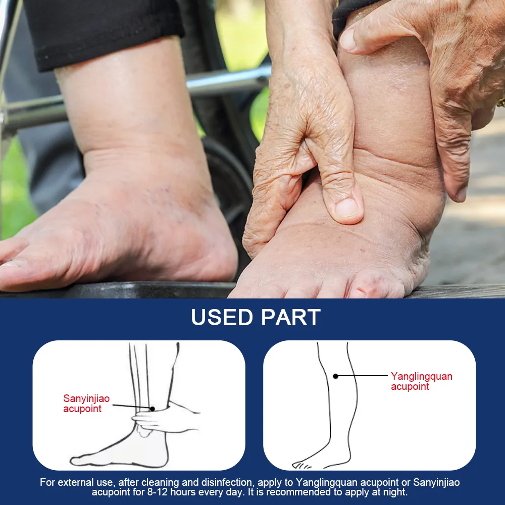 Sumifu Edema Patch Amazon Shrimp Skin Temu Cross border Leg Edema Foot Care Sub Health K17301 4