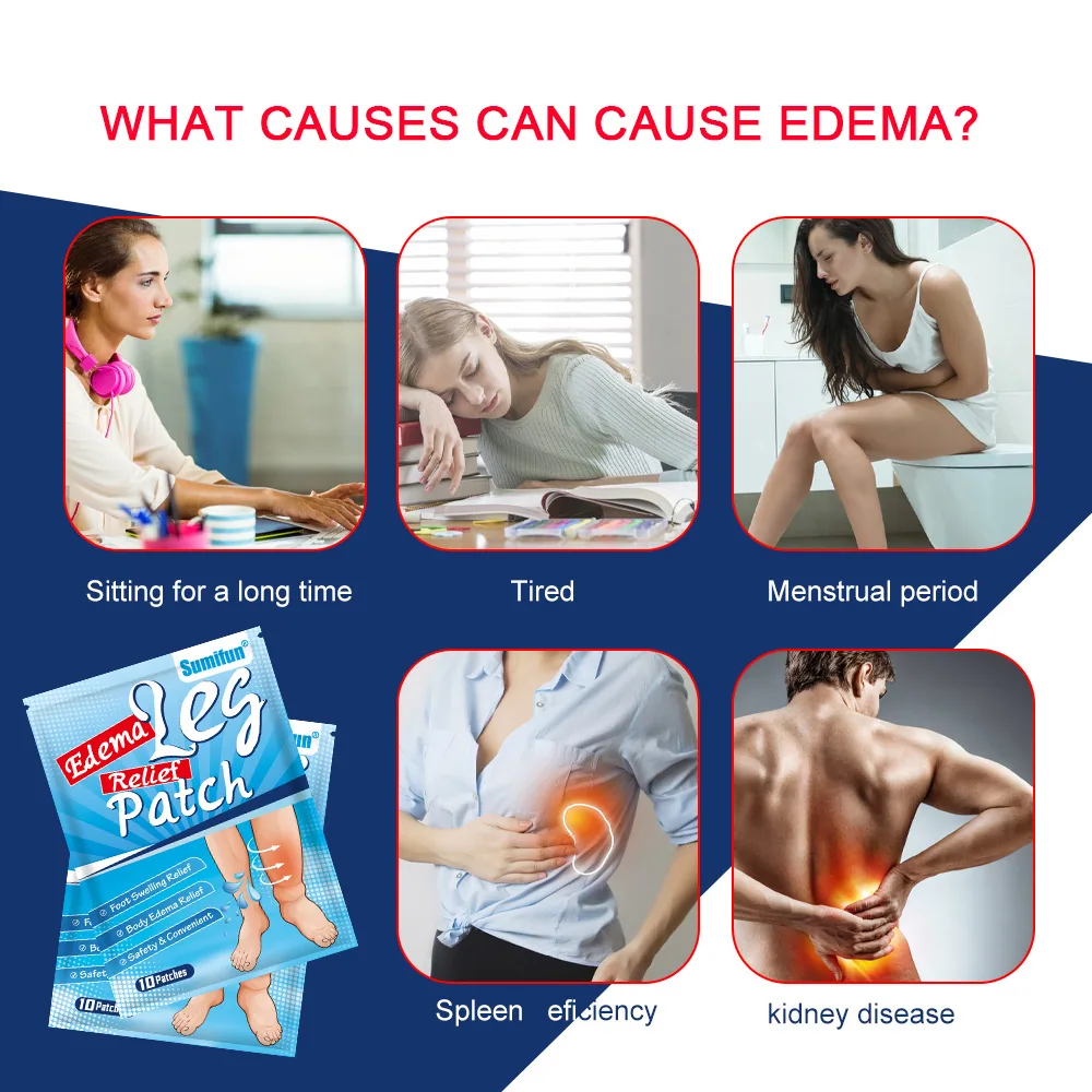 Sumifu Edema Patch Amazon Shrimp Skin Temu Cross border Leg Edema Foot Care Sub Health K17301 5