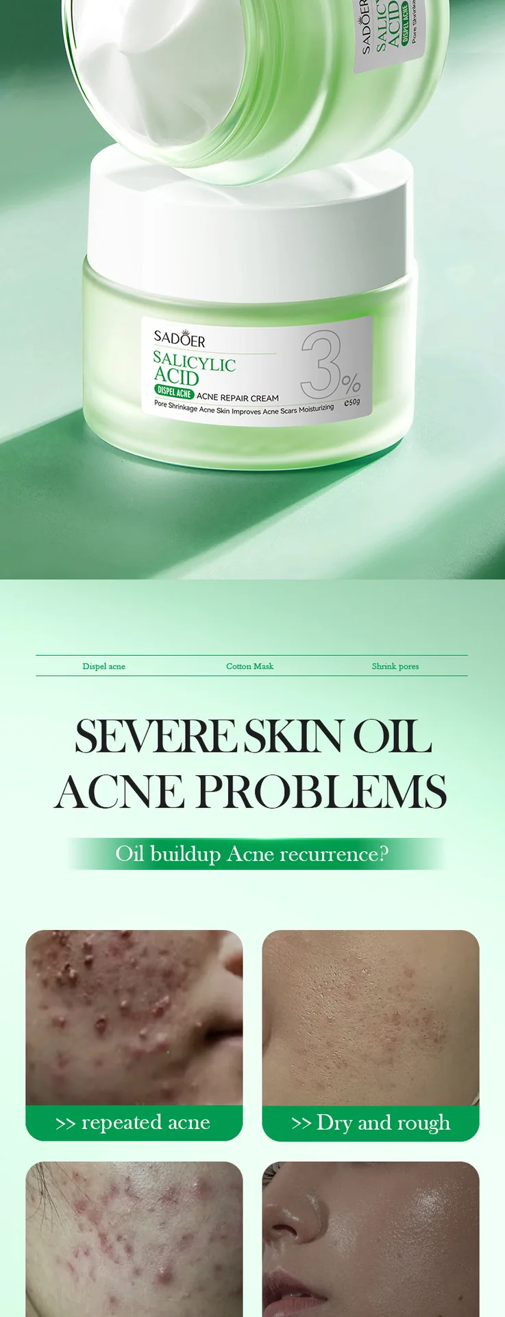 SADOER Salicylic Acid Acne Removing face cream Instructions on the back of the package Usage and precautions Cross border who