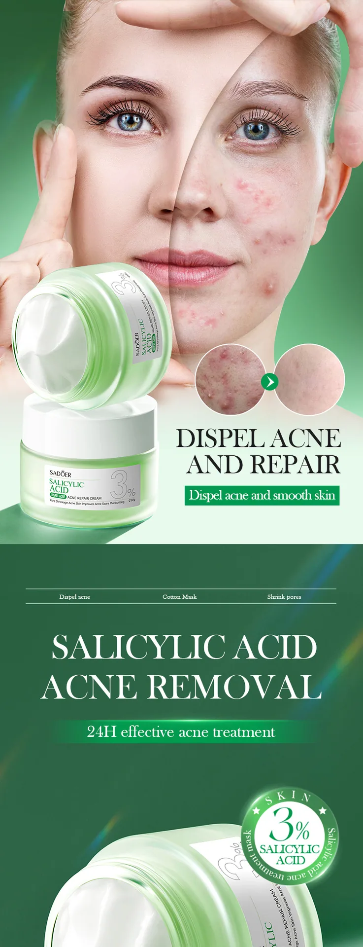 Close up of details of SADOER salicylic acid acne removing and repairing cream, texture display of Student Party moisturizing