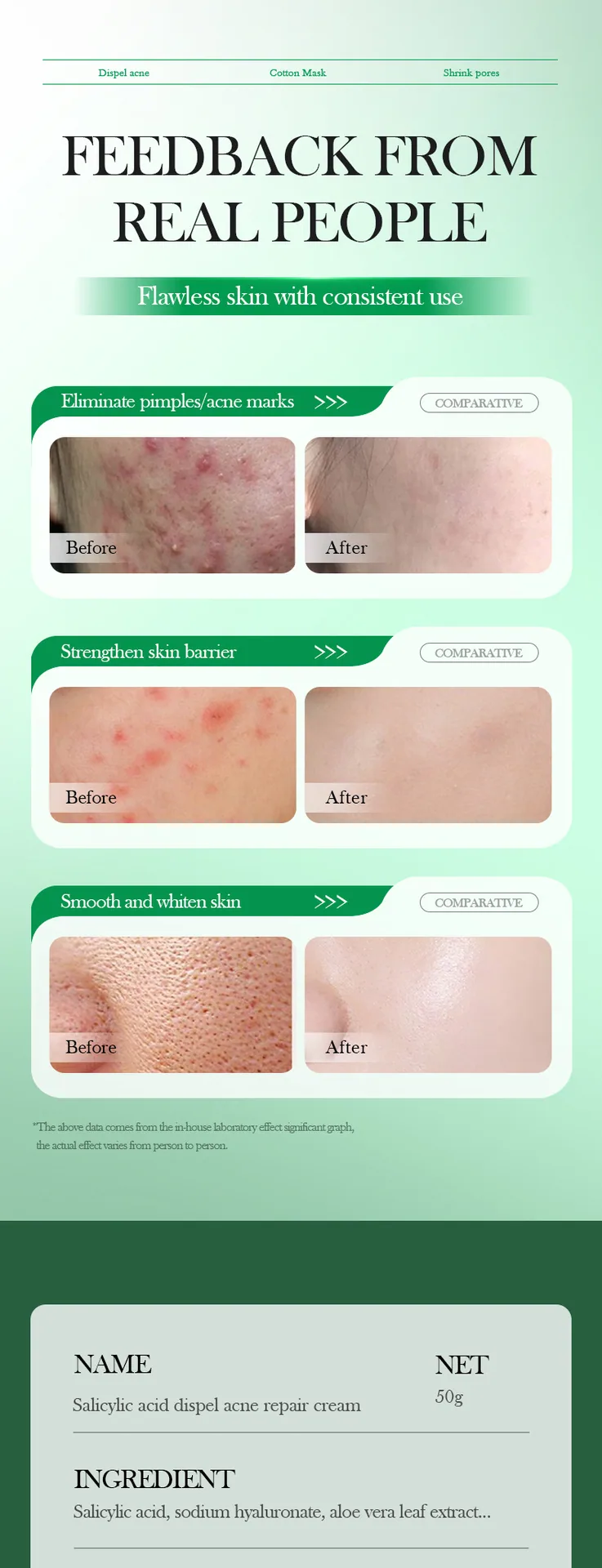 The contrast scene before and after the use of SADOER Salicylic Acid face cream, the demonstration of acne removing and moist