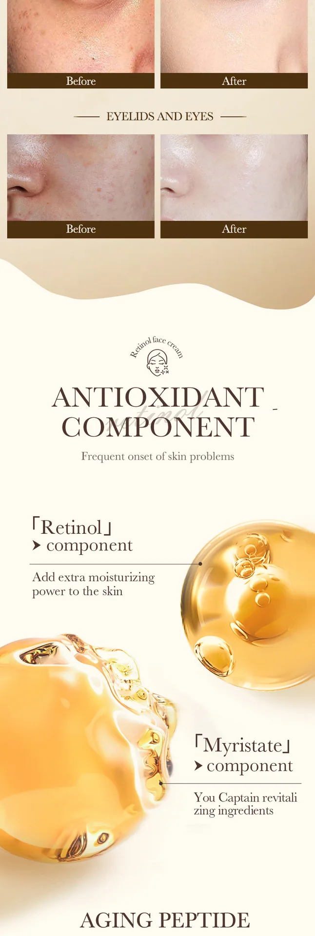 SADOER Retinol face cream Multi specification Color Style Optional Cross border Wholesale Difference Diagram
