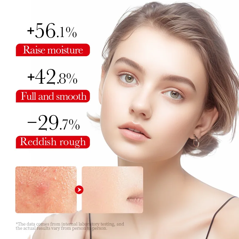 SADOER Ceramide Soothing&Repairing face cream Sensitive Skin Moisturizing Cross border Foreign Trade Wholesale 4th Detail